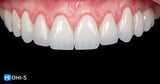 Ceramic Layering: Protocols from the World's Leading Schools