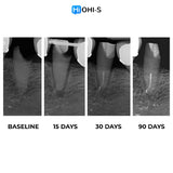 Saving Hopeless Teeth: Surgical and Conservative Protocols
