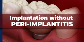 Implantation without peri-implantitis