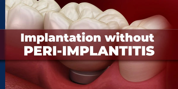 Implantation without peri-implantitis