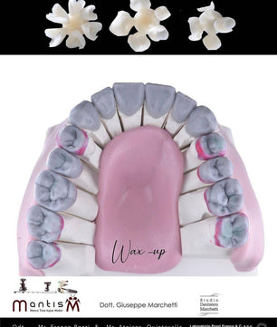 Ceramic Restorations:  Veneers, Inlays, Crowns - Dental Courses | كورسات طب اسنان