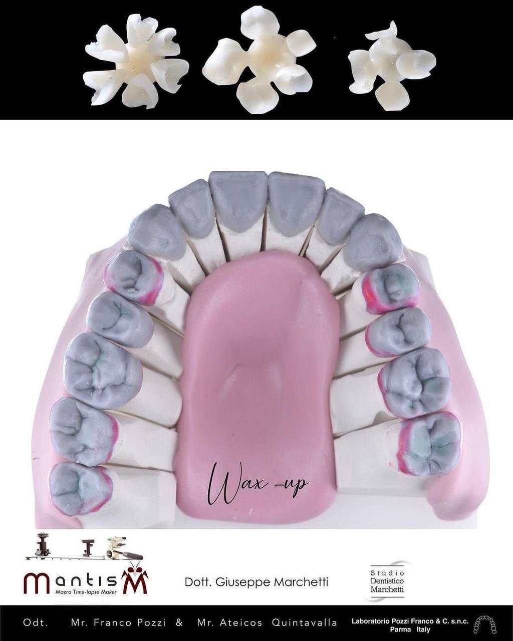 Ceramic Restorations:  Veneers, Inlays, Crowns - Dental Courses | كورسات طب اسنان