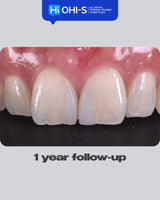 International Schools Working with Composite Restorations