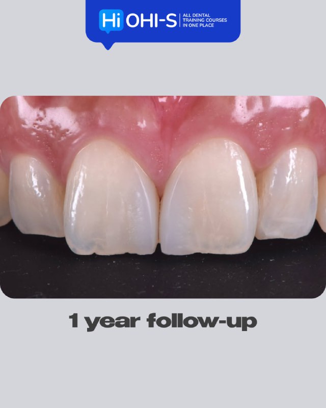 International Schools Working with Composite Restorations