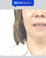 International Schools Working with Composite Restorations