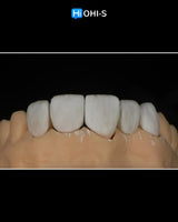 Ceramic Layering: Protocols from the World's Leading Schools