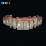 Removable dentures for dentists and technicians