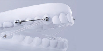 The Sagittal First concept: Treatment of Most Common Malocclusions