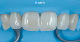 International Schools Working with Composite Restorations
