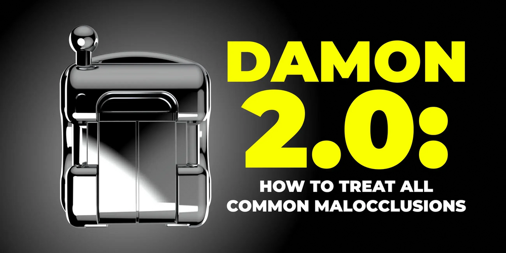 Damon 2.0. How to treat all common malocclusions