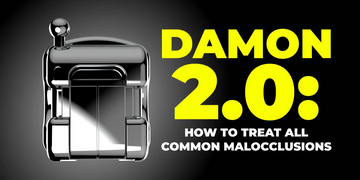Damon 2.0. How to treat all common malocclusions