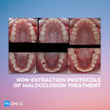 Early Orthodontic Treatment: When and How?