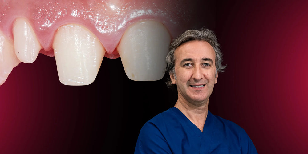VertiPrep and Ceramic veneers: online workshop by Fabio Scutella