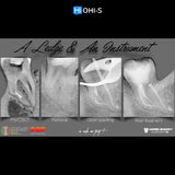 Saving Hopeless Teeth: Surgical and Conservative Protocols
