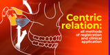 Centric Relation: All Methods of Registration and Clinical Application