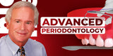 Advanced Periodontology: Surgical Protocols