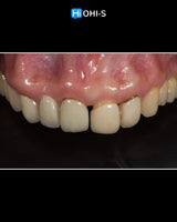 Ceramic Layering: Protocols from the World's Leading Schools