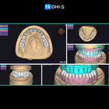 Removable dentures for dentists and technicians