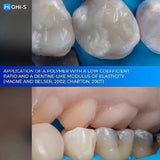 The Biomimetic Concept: Composite Restoration Protocols