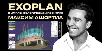 EXOPLAN in implantology practice