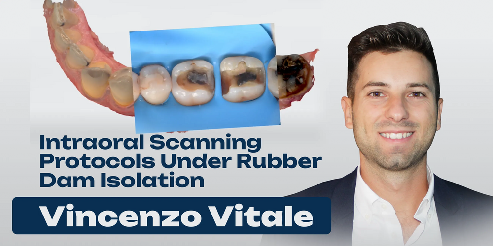 Intraoral Scanning Protocols Under Rubber Dam Isolation. Step-by-Step Video Guide