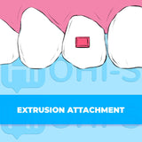 Aligners: Advanced Course — Treatment of Complex Clinical Cases