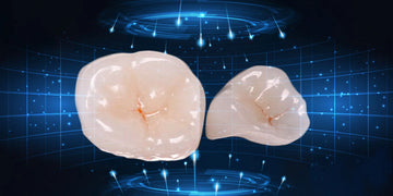 Ceramic Restoration Protocol Using CEREC Technology