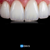 Ceramic Layering: Protocols from the World's Leading Schools
