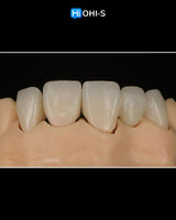 Ceramic Layering: Protocols from the World's Leading Schools