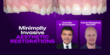 Minimally Invasive Aesthetic Restorations: Additive, Digital and Functional Rehabilitation