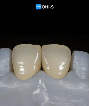 Ceramic Layering: Protocols of the World’s Leading Schools - Dental Courses | كورسات طب اسنان