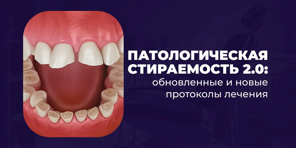 Патологическая стираемость 2.0: обновленные и новые протоколы лечения