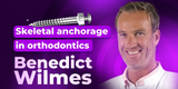 Challenging orthodontic cases: the use of skeletal anchorage