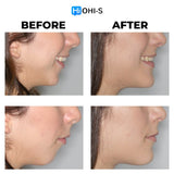 TMJ Stabilization and Remodeling: Occlusal Plane, Posture, MRI and Splints