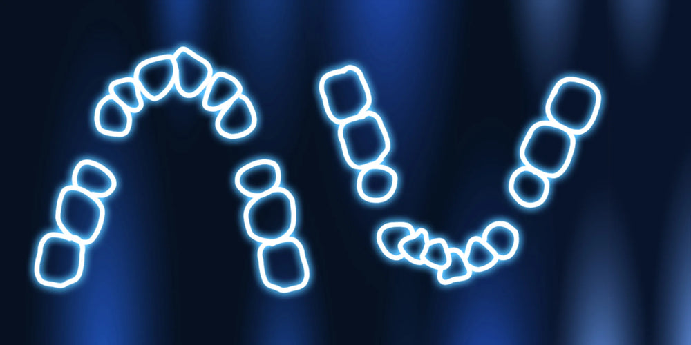 Extractions in orthodontics: aligners, braces, microimplants, transpalatal arches