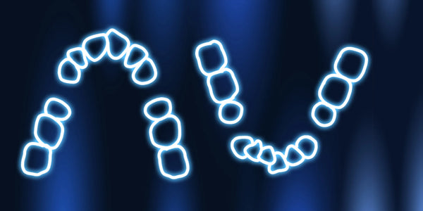 Extractions in orthodontics: aligners, braces, microimplants, transpalatal arches