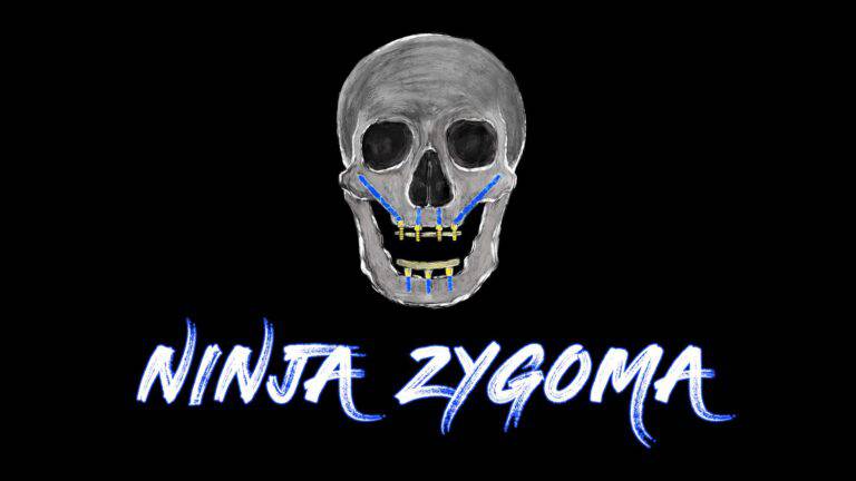 Ninja Zygoma – Implant Ninja - Dental Courses | كورسات طب اسنان
