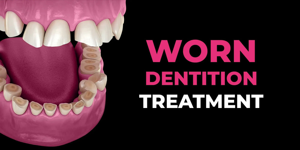 Worn dentition treatment