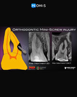 Saving Hopeless Teeth: Surgical and Conservative Protocols