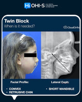 Orthodontics for Children and Teenagers