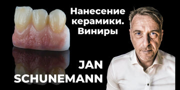 Ceramic Application: Veneers
