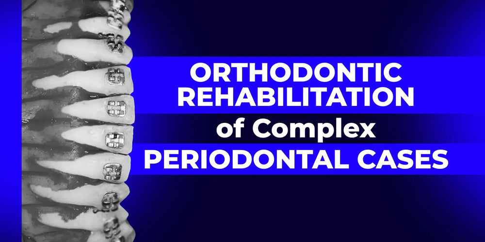 Ortho-Perio Approach: Treatment of Patients with Dentofacial Anomalies and Periodontal Diseases