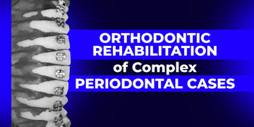 Ortho-Perio Approach: Treatment of Patients with Dentofacial Anomalies and Periodontal Diseases