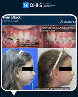 Orthodontics for Children and Teenagers