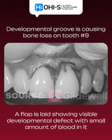 Advanced Periodontology: Surgical Protocols