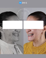 Centric Relation: All Methods of Registration and Clinical Application