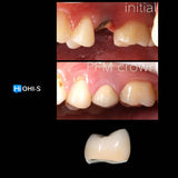 Saving Hopeless Teeth: Surgical and Conservative Protocols