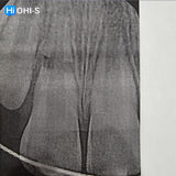 Dental Trauma Without Drama