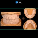 Removable dentures for dentists and technicians