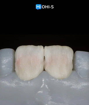 Ceramic Layering: Protocols of the World’s Leading Schools - Dental Courses | كورسات طب اسنان